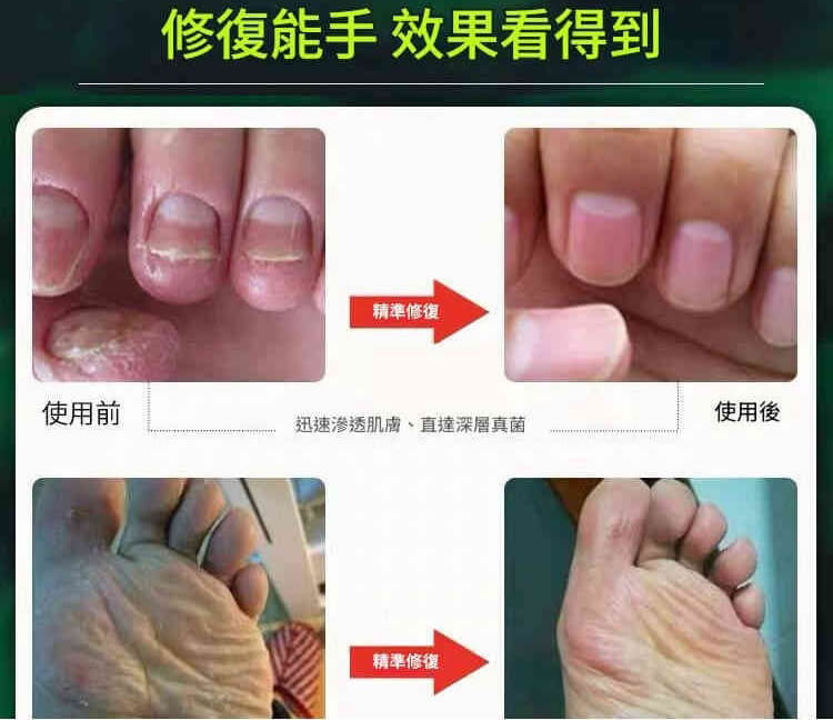 琴逸堂抑菌膏1781265351316920.jpg 琴逸堂抑菌膏